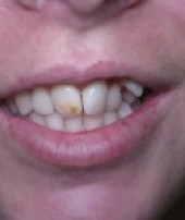 orthodontist-services-3-1